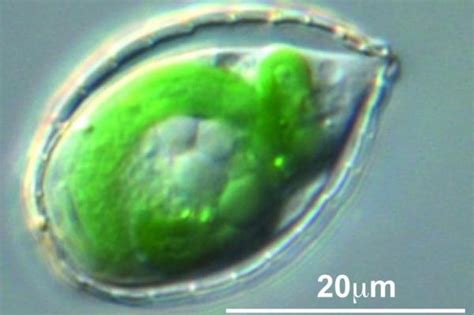  Ellipsosolenia! Desvendando os Mistérios de uma Ameba Elíptica