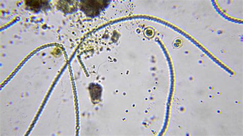  Kickxellomyxa! Uma História Misteriosa de um Protista Flagelado que Faz da Floresta seu Lar